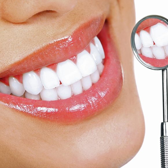 Λεύκανση Δοντιών