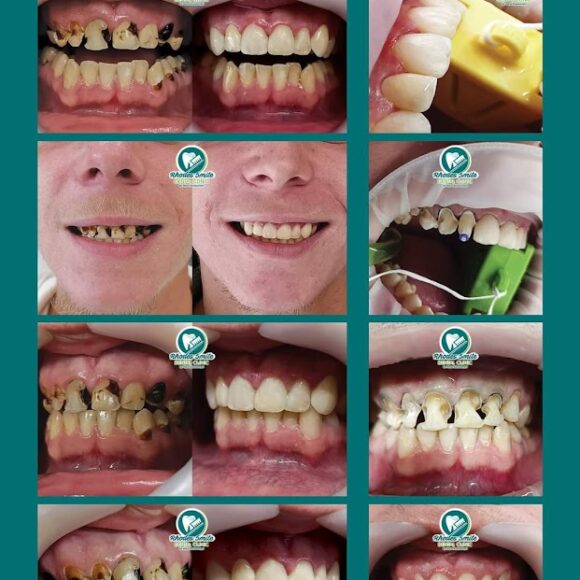 Από τον πολυτερηδονισμό σε ένα υγιές και αισθητικά ισορροπημένο χαμόγελο